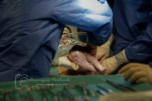 Geboortefotograaf Monique Verbeek keizersnede Utrecht