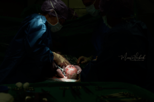 keizersnede fotograaf utrecht