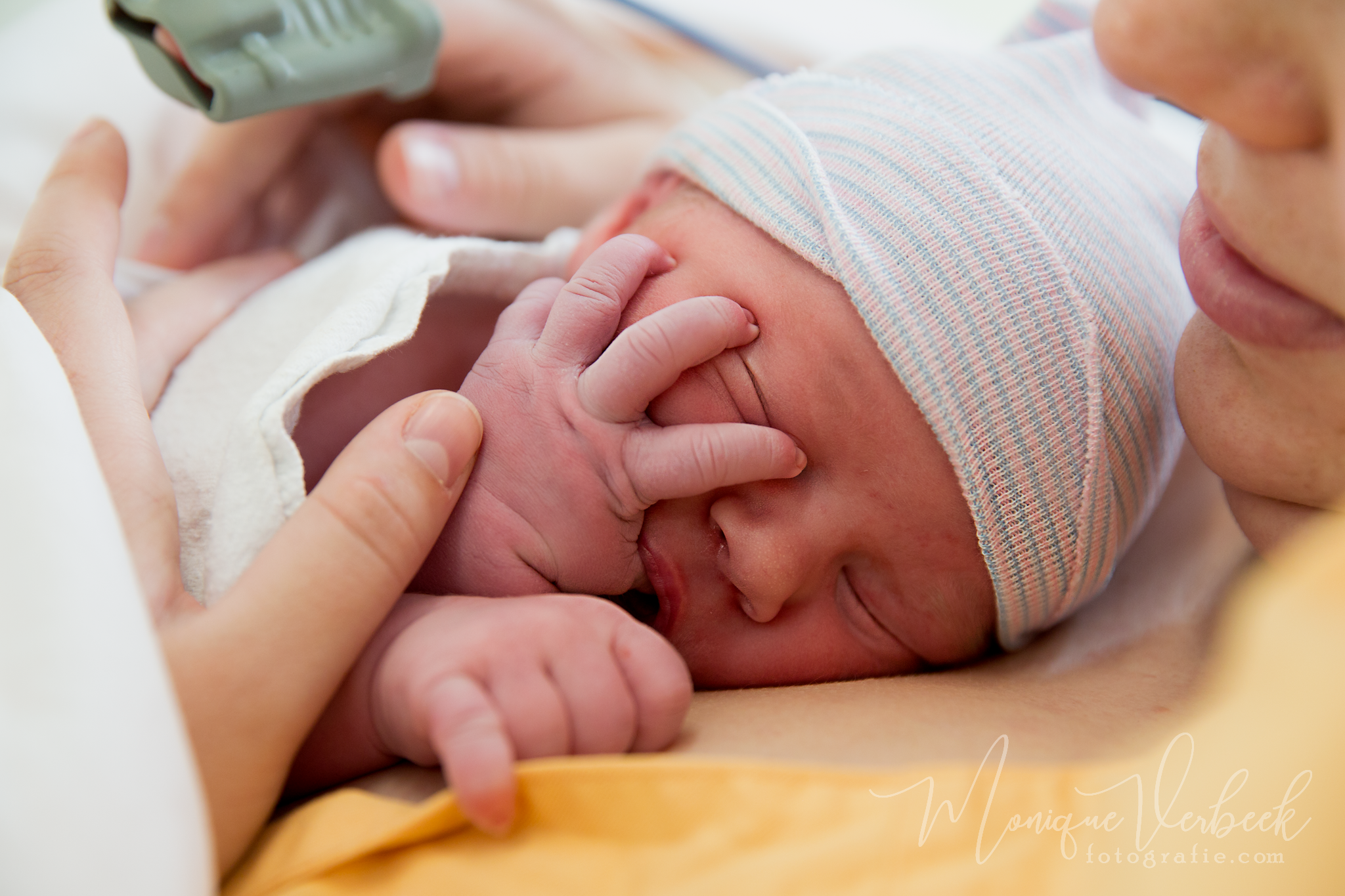 geboortefotografie Utrecht keizersnede