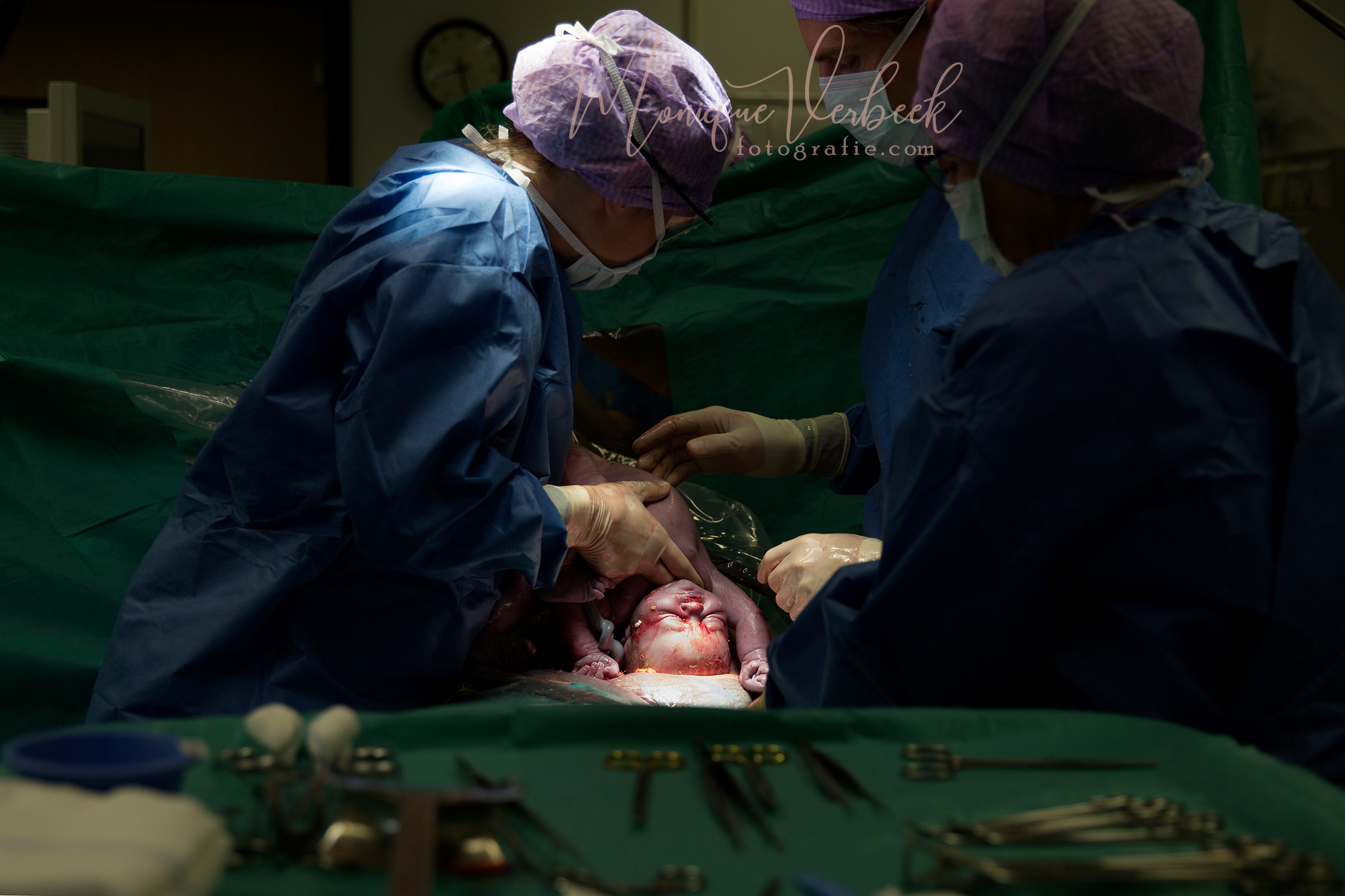geboortefotografie Utrecht keizersnede