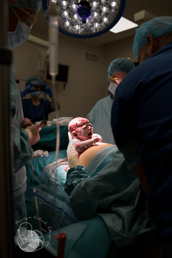 geboortefotograaf Utrecht keizersnede MAC