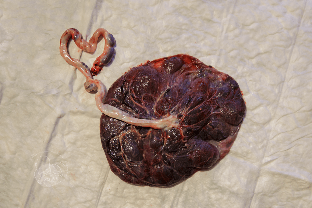 Een natuurlijke stuitbevalling