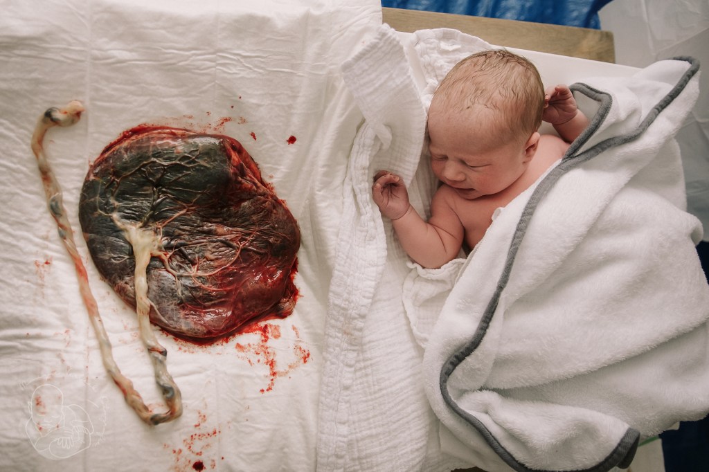 Hoe ziet een placenta er eigenlijk&nbsp;uit?