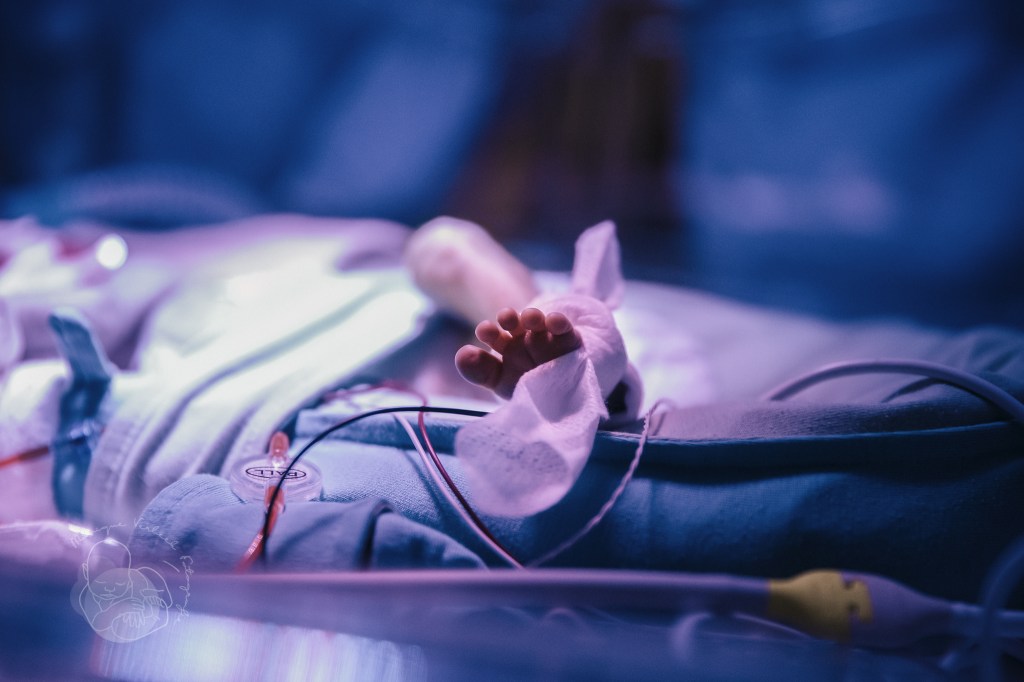 babyvoetje onder de blauwe lamp 