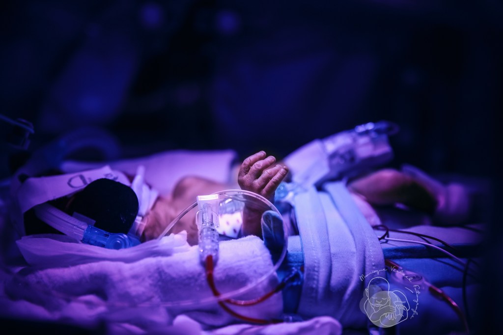 Blauwe lamp op de nicu