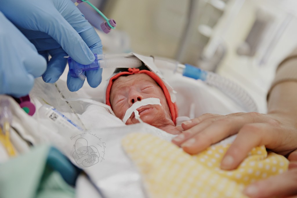 Eventjes zonder ademhalingsondersteuning tijdens een verzorgingsmomentje