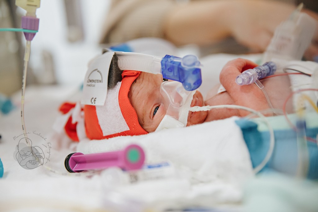 cpap beademing op de nicu