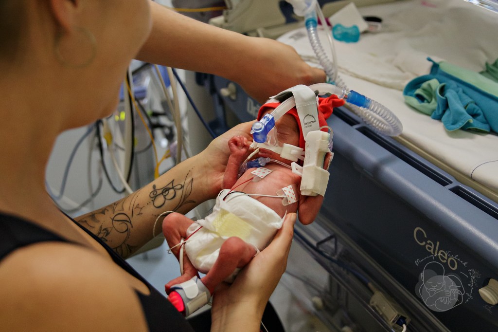 In het WKZ Wilhelmina Kinderziekenhuis worden de jongste kindjes verzorgd.