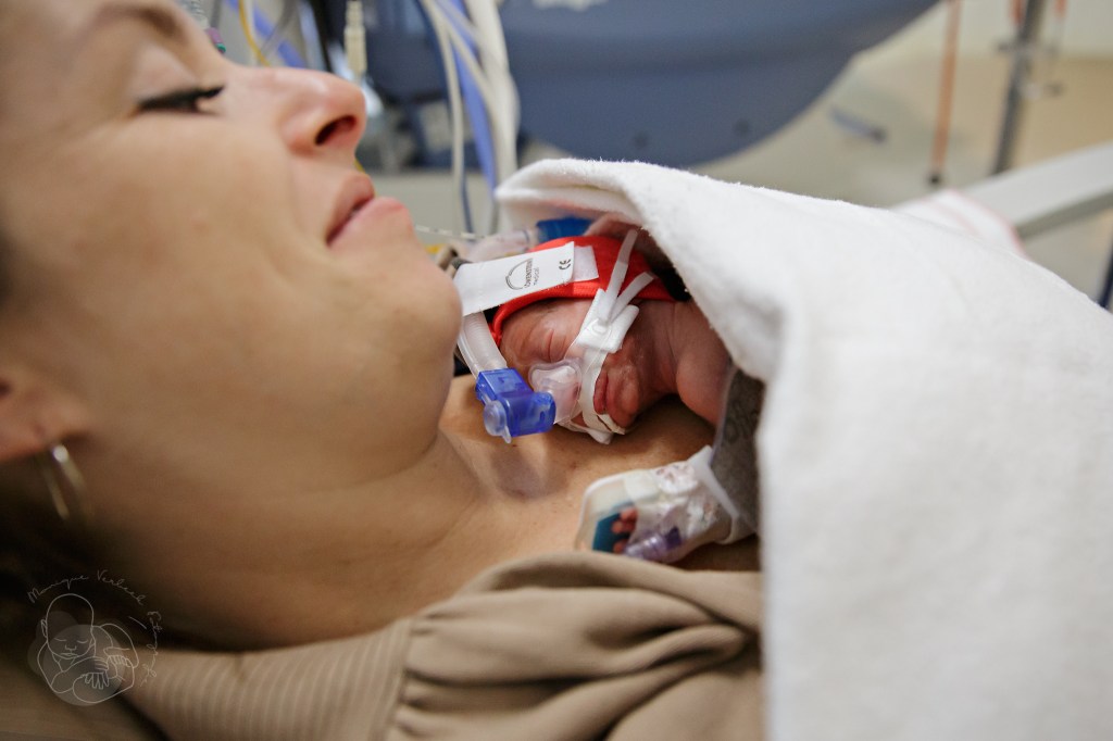 heerlijk je baby huid op huid