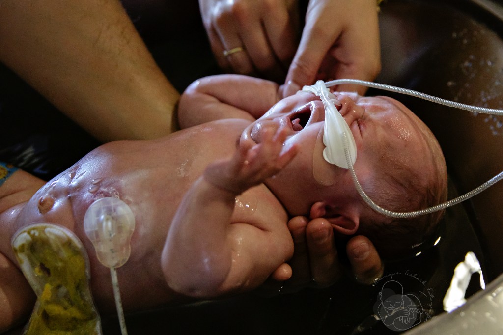 Papa houdt haar vast in bad terwijl mama haar lekker wast. Door het warme water komt het stomazakje vanzelf los zodat het daarna verwisselt kan worden.