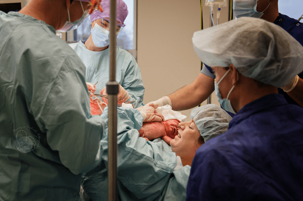 Zelf navelstreng doorknippen bij keizersnede